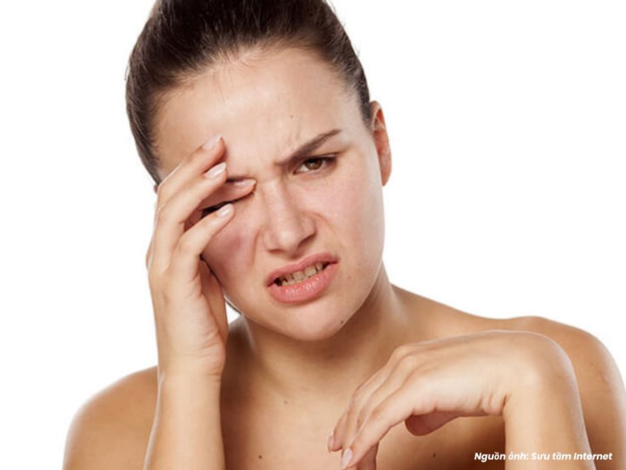 nguyên nhân mắt phải giật thường do stress, thiếu ngủ, hoặc khô mắt kéo dài